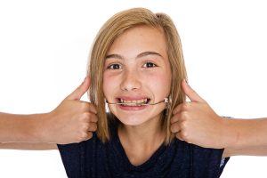 child smiling with retainer